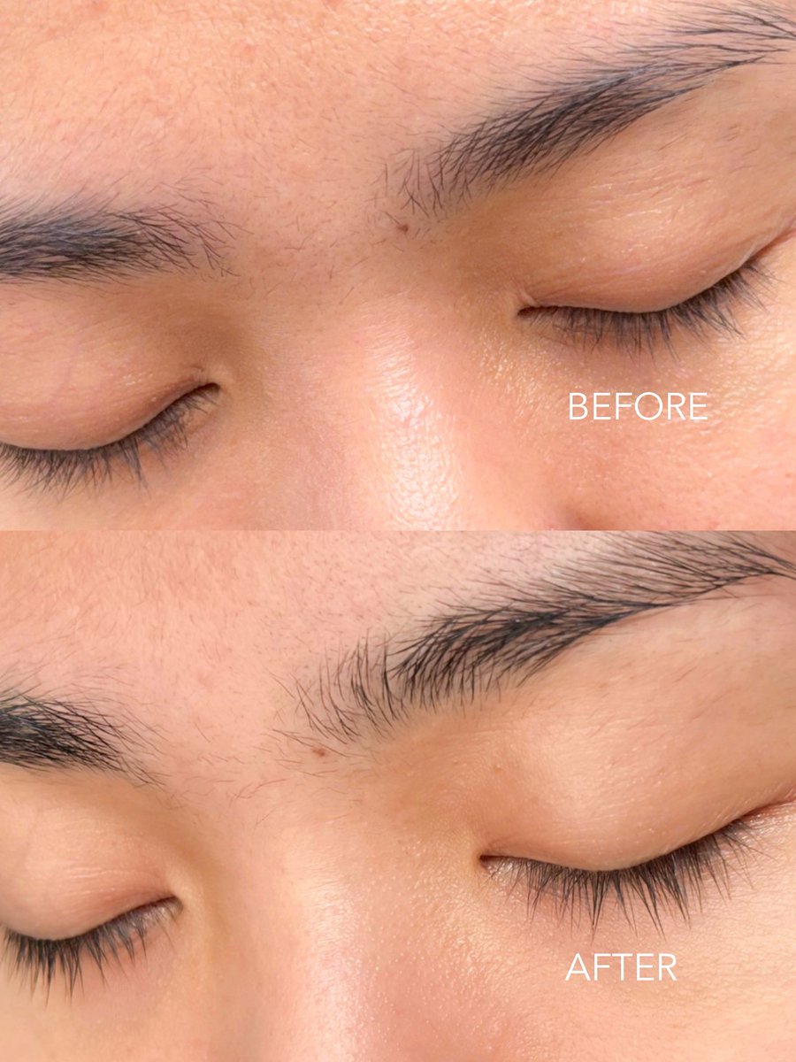 beautyayyy's tweet photo. liat deh eyelash ak makin tebal &amp; panjang👀

udh ga takut rontok lagi soalnya pake eyelash serum🤪 https://t.co/GFCiKSvCKp