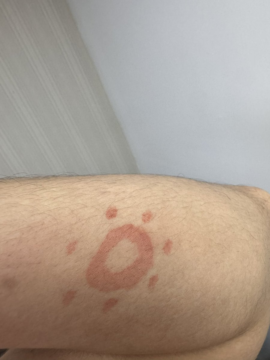 gawincaskey's tweet image. Kissed by the sun ☀️ 

SUNKISSER X JOSSGAWIN
#MaybellinexJossGawin