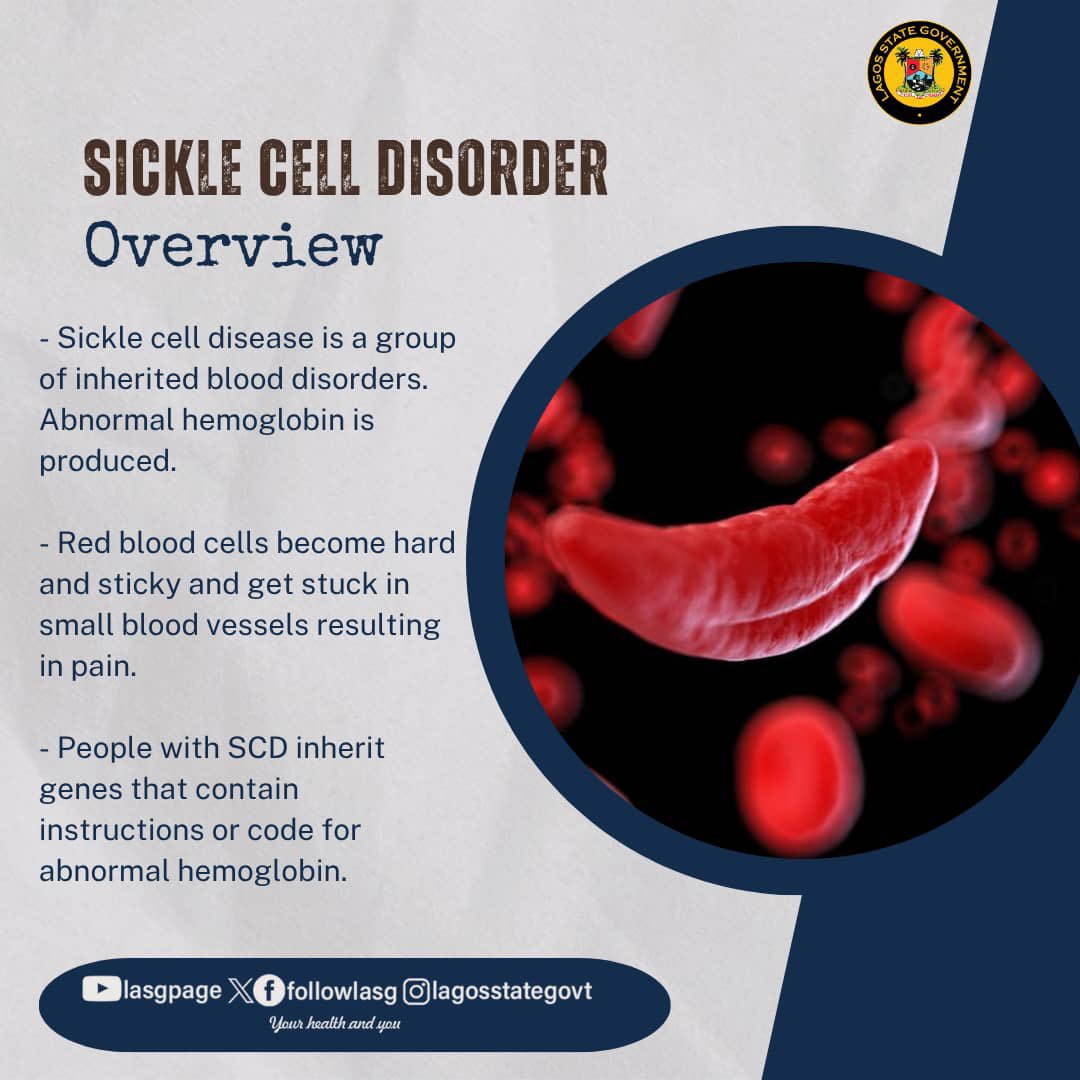 followlasg's tweet photo. The most common complication of sickle cell disease (SCD) is pain, often occurring as acute pain crises (also known as vaso-occlusive crises or VOEs).

@jidesanwoolu 
@drobafemihamzat 
@gbenga_omo @gboyegaakosile @BSaluHundeyin @Mr_JAGs @Riddwane 

#AGreaterLagosRising 
#LASG
#SickleCellDisorder
#LSMoH
#YourHealthAndYou