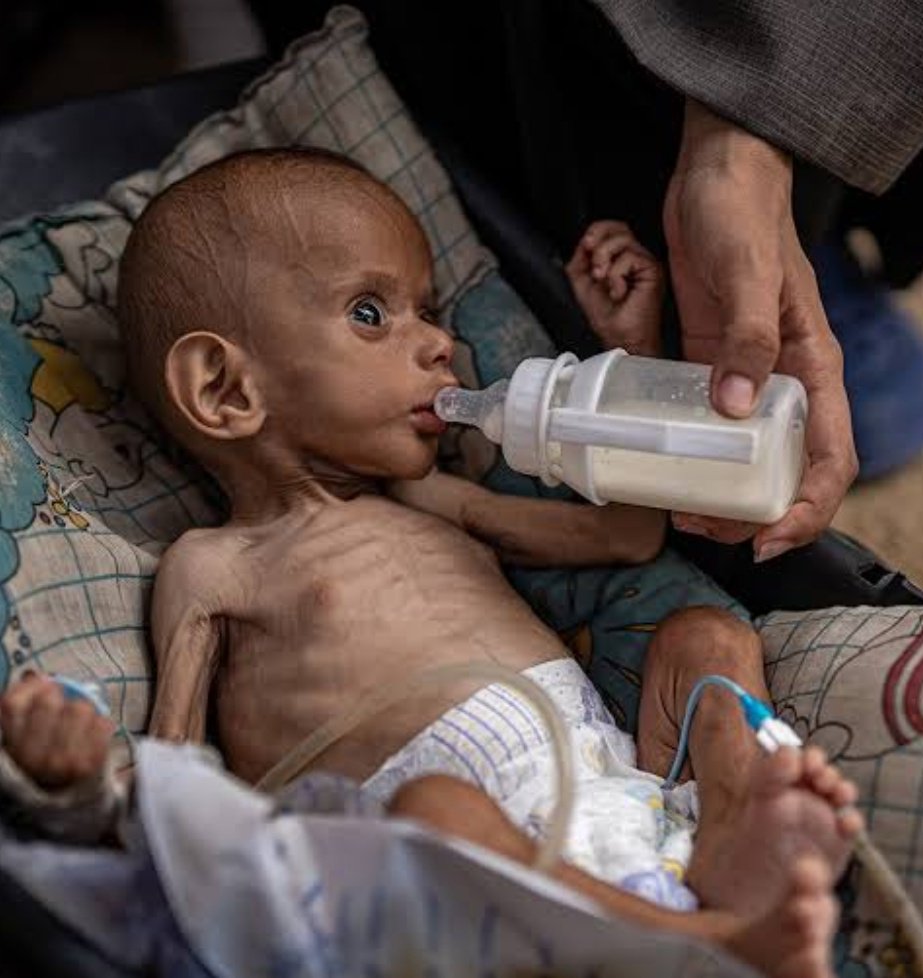 Look at this little angel he is hungry💔If you see this pic, reply with 🍉🇵🇸 and spread it 💔