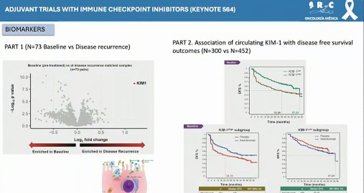 Dra. María Natalia Gandur Quiroga (@nataliagandur) on Twitter photo 🌟 Adjuvant Therapy in Renal Cancer
👨⚕️ Presented by <a href="/JaviMolinaC/">Javier Molina Cerrillo</a>
#GUARDSymposium2025 <a href="/OncoAlert/">OncoAlert</a>
📌 Current status:
▪️ Pembrolizumab (KN564) = approved, DFS+ but OS data immature
▪️ CheckMate 914 & PROSPER = negative
▪️ No predictive biomarkers
▪️ Ongoing: RAMPART, LITESPARK-022 🌟 Adjuvant Therapy in Renal Cancer
👨⚕️ Presented by <a href="/JaviMolinaC/">Javier Molina Cerrillo</a>
#GUARDSymposium2025 <a href="/OncoAlert/">OncoAlert</a>
📌 Current status:
▪️ Pembrolizumab (KN564) = approved, DFS+ but OS data immature
▪️ CheckMate 914 & PROSPER = negative
▪️ No predictive biomarkers
▪️ Ongoing: RAMPART, LITESPARK-022