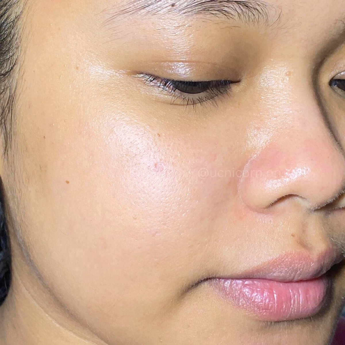 sekarang udah ga khawatir lagi kalo muka tiba-tiba rewel, tinggal semprot pake ini✨

REDNESS, GATAL, JERAWAT? GA SAMPE SATU MENIT BAKTERI LANGSUNG MINGGAAATTT🙂‍↔️

before                                         after