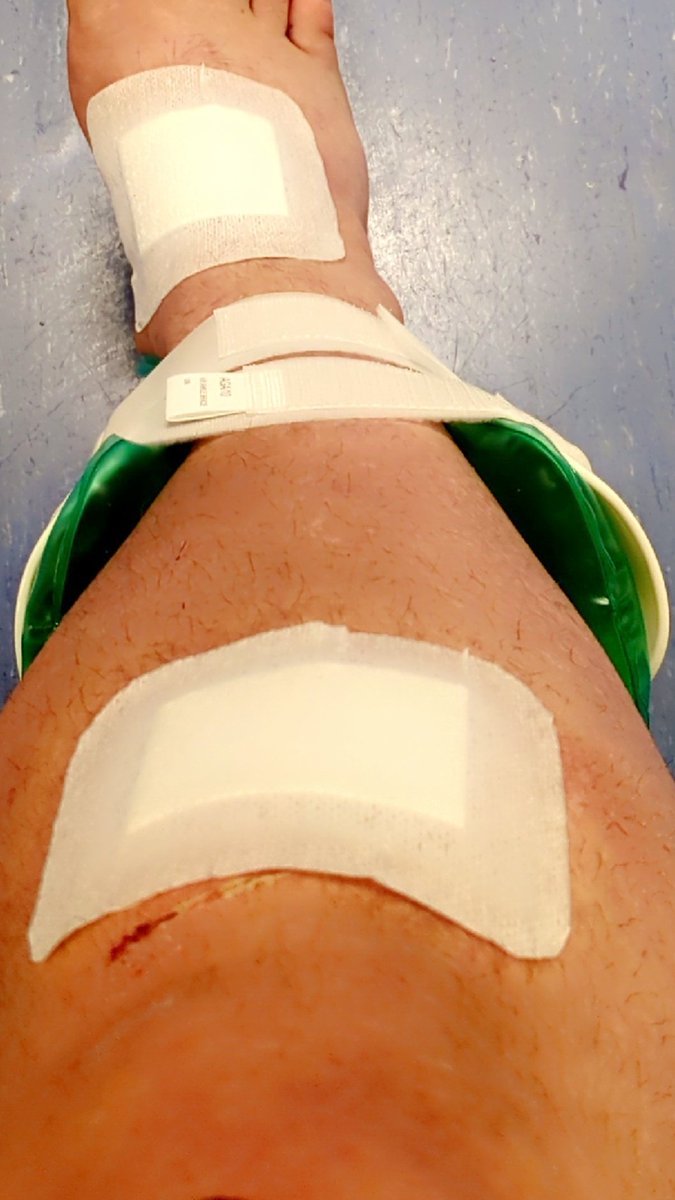 This is probably the easiest way to let people know. Yesterday I was involved in a car accident. A car turned across my path causing me to hit it head on and go flying off my motorbike and over the bonnet. I've come off very lucky. A few weeks on crutches with a splint and rest