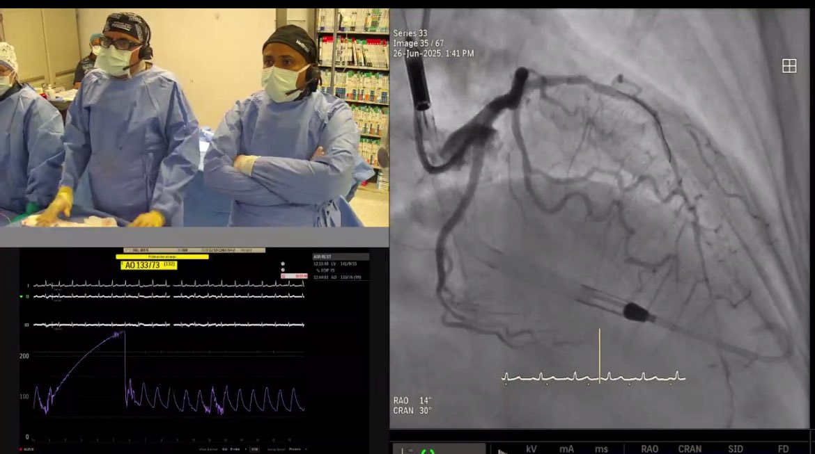 KFAFHCards (@kfafhcards) on Twitter photo Congratulations <a href="/KFAFHCards/">KFAFHCards</a> on a great demonstration of IVUS guided PCI of LM with Impella CP support
Operators: <a href="/assiri99/">Salem Assiri, MD, FACC</a> <a href="/wagarhabib/">wagar ahmed د. وقار حبيب</a>
Moderator: <a href="/mirvatalasnag/">MIЯVΛƬ #IC</a>
Fellow In Training: <a href="/ibalsaadi/">Ibrahim Alsaadi MD</a>
Thank you CardioPearl for the invitation 🇪🇬 Congratulations <a href="/KFAFHCards/">KFAFHCards</a> on a great demonstration of IVUS guided PCI of LM with Impella CP support
Operators: <a href="/assiri99/">Salem Assiri, MD, FACC</a> <a href="/wagarhabib/">wagar ahmed د. وقار حبيب</a>
Moderator: <a href="/mirvatalasnag/">MIЯVΛƬ #IC</a>
Fellow In Training: <a href="/ibalsaadi/">Ibrahim Alsaadi MD</a>
Thank you CardioPearl for the invitation 🇪🇬