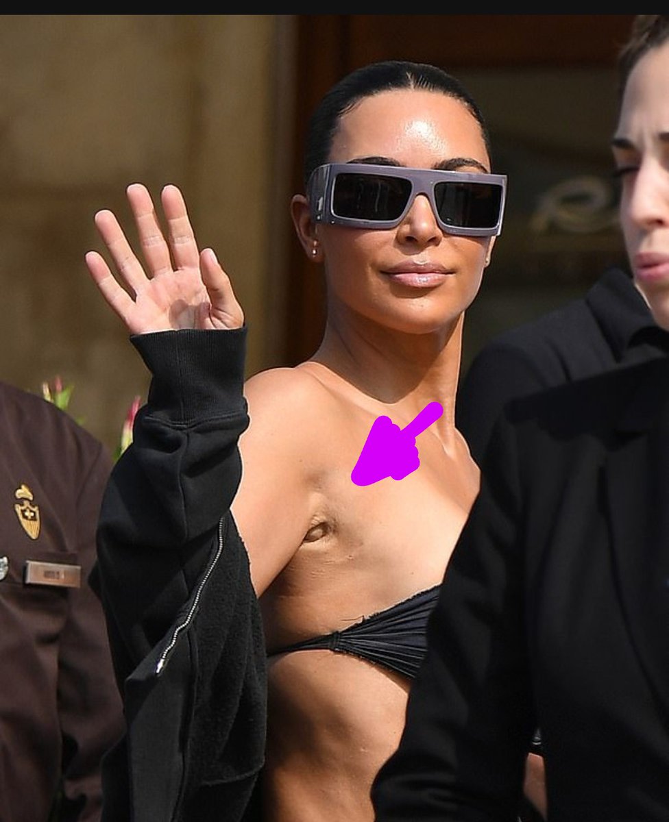 eww <a href="/KimKardashian/">Kim Kardashian</a> wtf is wrong with your underarm? 😬😳🫣 #jeffbezoswedding #KimKardashian #bezoswedding #bezossanchez
