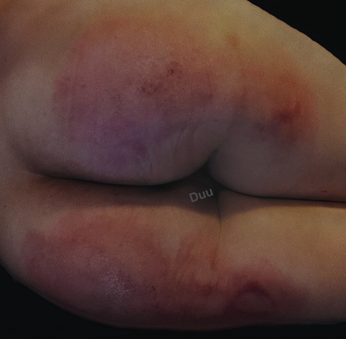 DuuSpank's tweet photo. 今日训诫 #spanking #打屁股 https://t.co/LXA1RtG8zD
