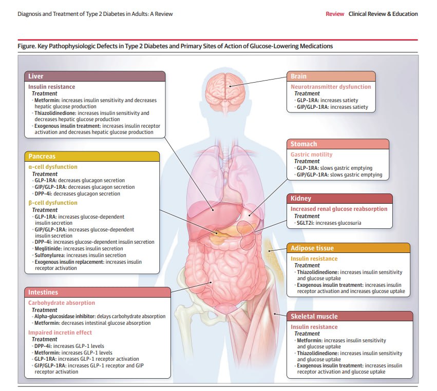 📚Diagnosis and Treatment of Type 2 Diabetes in Adults (JAMA, 2025)🧵1️⃣🔥 Actualización en diabetes tipo 2 – JAMA 2025✅
🧵2️⃣📊 Epidemiología
🔹 Afecta al 11–14% de la población mundial
🔹 1 de cada 6 adultos en EE. UU.
🔹 90–95% de todos los casos de diabetes
🔹 Su carga es
