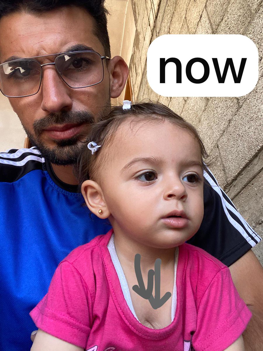 Look at how Rafif has changed, how she loses weight day by day. Ignore the looks towards me and my thinness, I can bear it. But how can a child who hasn’t even turned one bear this, when she needs nourishment to build her body? All of this is due to the border closure and the