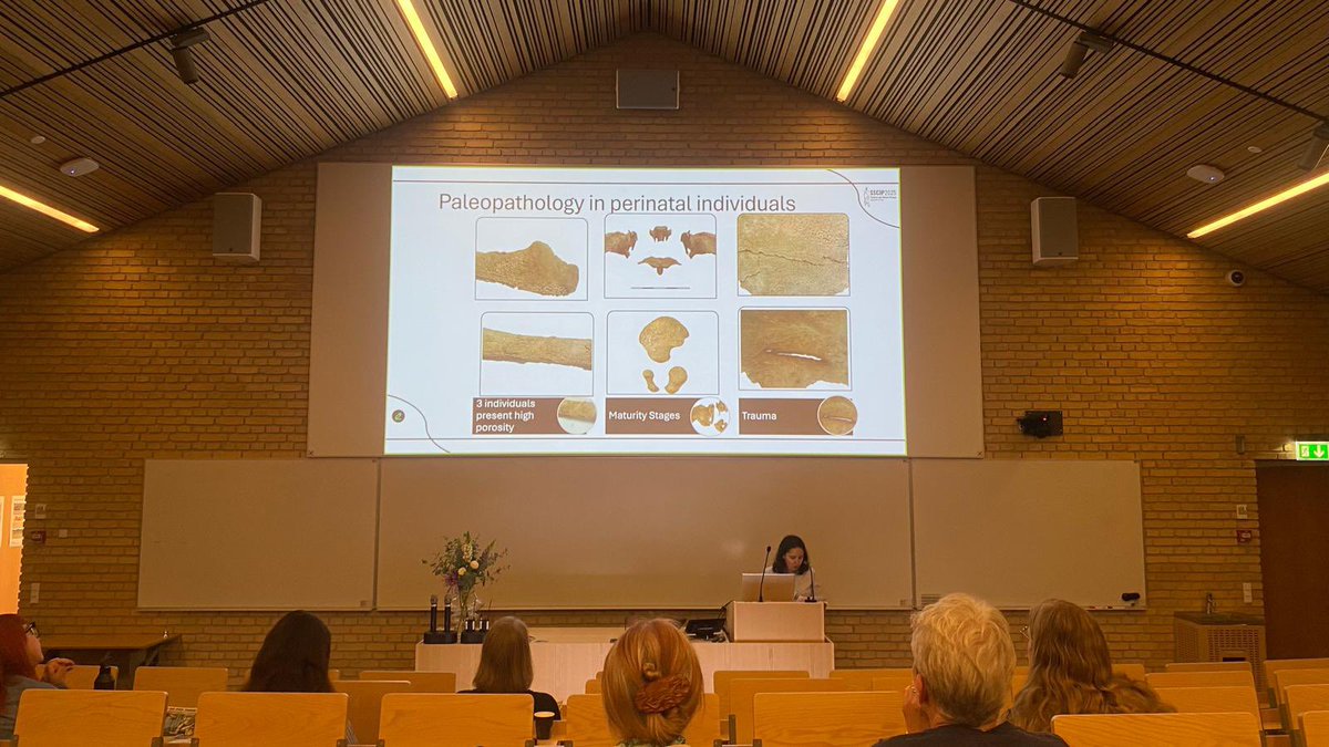 LaboratorioEH's tweet image. Hoy nuestras compañeras @AlbaNavPe @MartaFe00284440 y @mgbarreiro_ han estado en el #SSCIP2025 hablando sobre destete, un bebé enterrado en un campamento romano y un caso de displasia de cadera en un niño medieval.