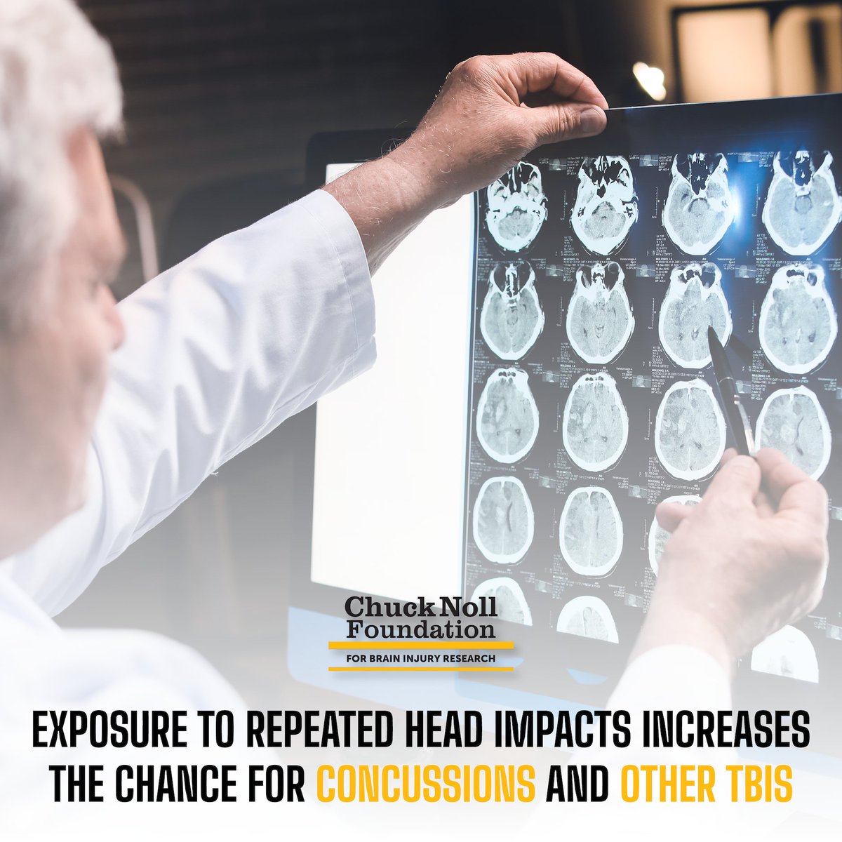 Repeated hits matter. 🧠

Exposure to repeated head impacts increases the risk of concussions and other traumatic brain injuries—even when there's no single major blow.

We’re funding research to better understand these risks and protect athletes at every level.