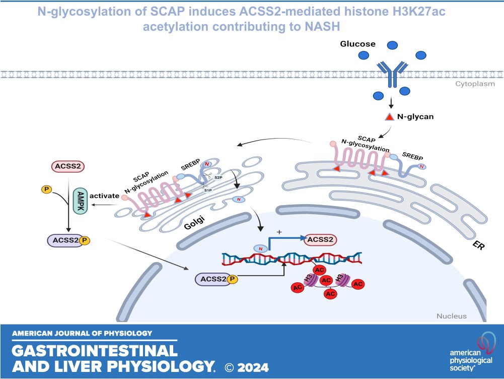 ajpgi's tweet image. From our #Gastrointestinal #Disease collection comes, N-glycosylation of SCAP exacerbates hepatocellular inflammation and lipid accumulation via ACSS2-mediated histone H3K27 acetylation #ThrowbackThursday (Xuemei Li et al.):

ow.ly/QnwP50WgPf5