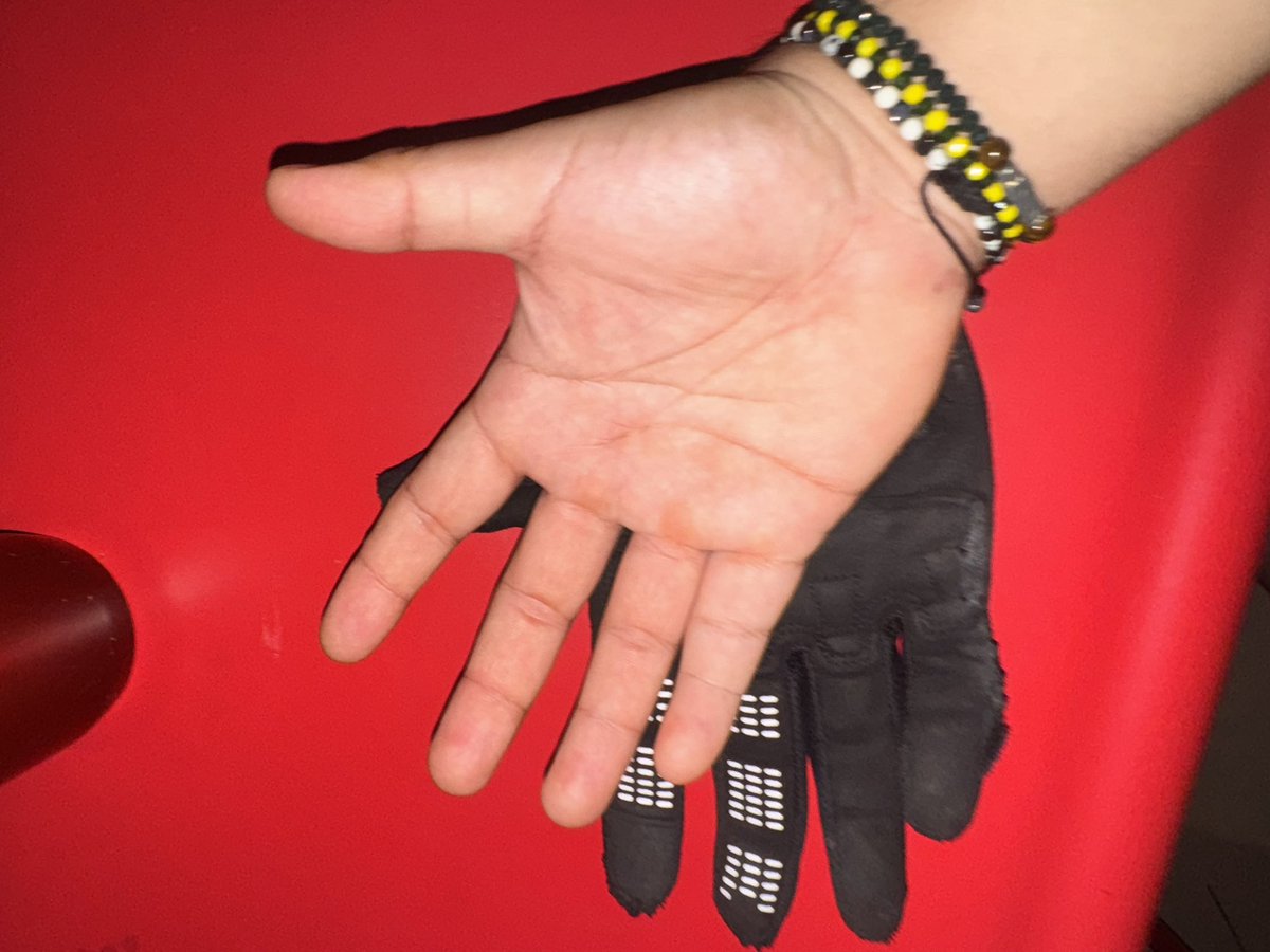 edwardsimuta's tweet photo. Grandes guantes los de @foxracing me caí y cumplieron su función a la perfección mi palma sin ningún rasguño https://t.co/CQbRv7bZLc