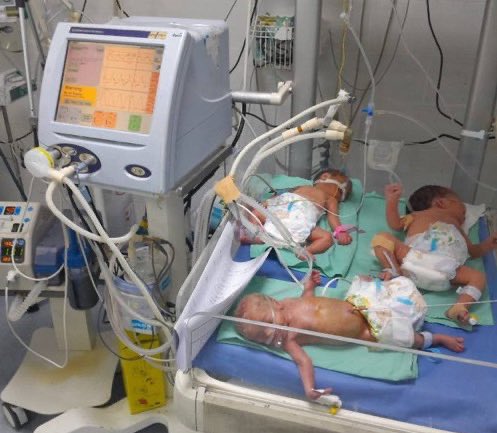 From <a href="/fnaim65/">Dr Fadel Naim</a> | with all neonatal incubators in Gaza City destroyed by the israelis, medics are forced to dangerously put 4 babies in one unit
