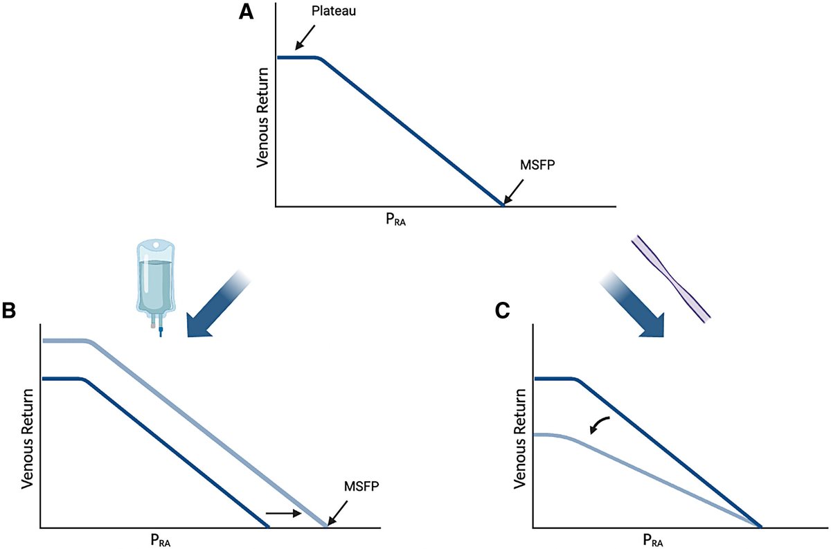 How I Teach: Heart–Lung Interactions during Mechanical Ventilation. Positive Pressure and the Right Ventricle 

How we teach the impact of positive pressure ventilation on right heart filling and emptying

<a href="/CardsNYC/">Eugene Yuriditsky</a> <a href="/carlosalviar/">Carlos L. Alviar MD, FACC FESC</a> <a href="/emireles_c/">Eduardo Mireles-Cabodevila</a>

🔗atsjournals.org/doi/full/10.34…