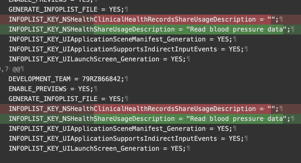 Xcode project generated by Xcode 26 doesn't contain Info.plist. Is it a new feature?..