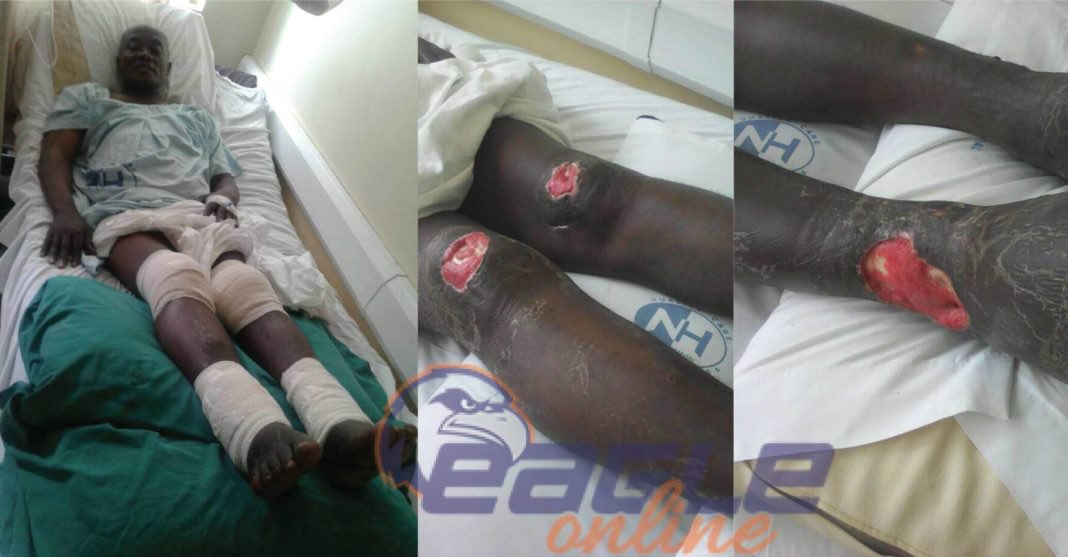 Nicholas Opiyo (Pronouns He/Him) (@nickopiyo) on Twitter photo (Graphic Image Warning) 
Recall the case of Geoffret Byamukama, the Kamwege Mayor, whose knees were gouged out while in (unlawful) detention at the infamous Nalufenya Police facility in Jinja? 
The people who did this were Minana and Muhangi, both of the notorious Flying Squad. (Graphic Image Warning) 
Recall the case of Geoffret Byamukama, the Kamwege Mayor, whose knees were gouged out while in (unlawful) detention at the infamous Nalufenya Police facility in Jinja? 
The people who did this were Minana and Muhangi, both of the notorious Flying Squad.