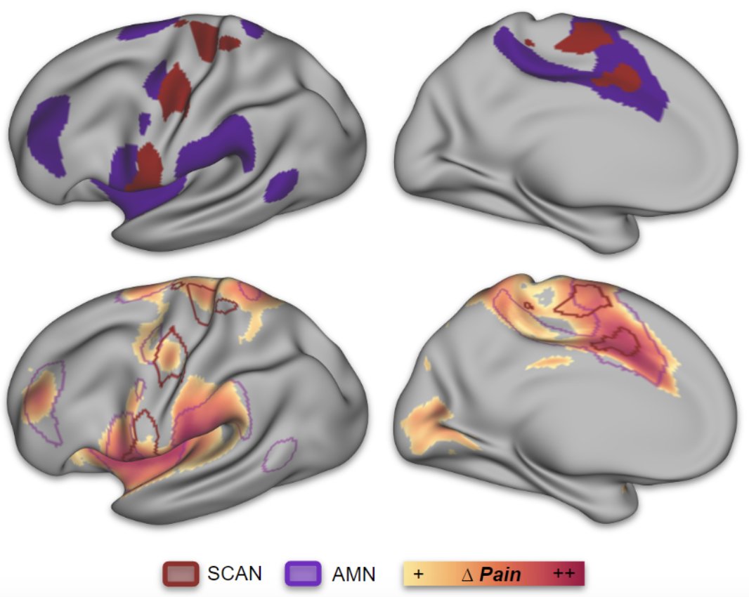 Pain in the brain!

check out the thread:
bsky.app/profile/drdami…

on the new preprint:
osf.io/preprints/psya…