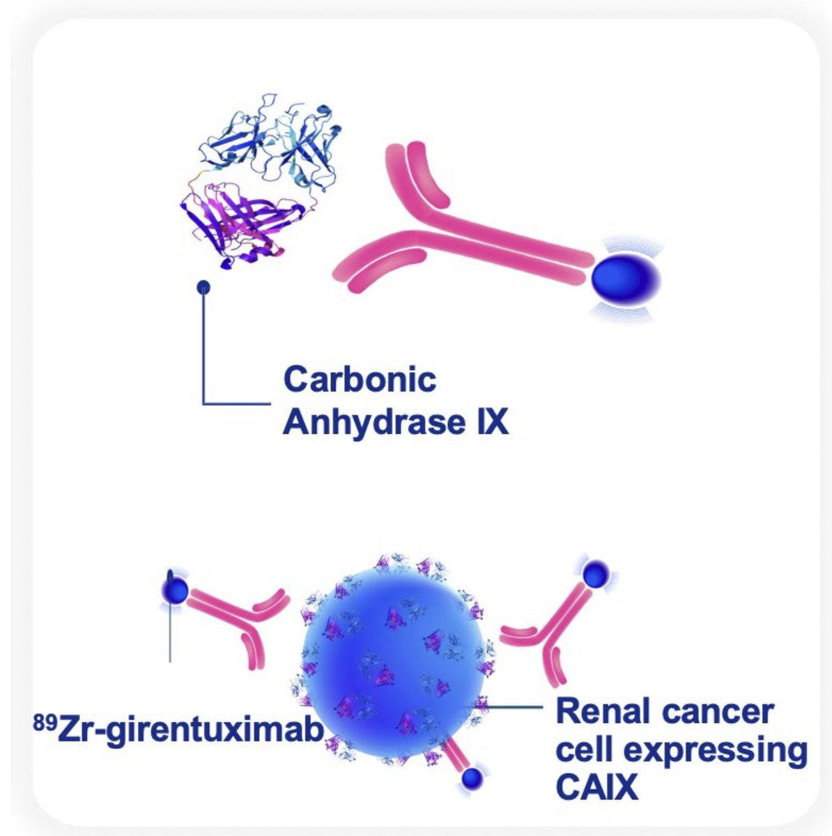UroToday.com (@urotoday) on Twitter photo Illuminating #RenalCancer: CAIX-PET imaging and the shift toward precision diagnostics. Presentation by <a href="/ShadiEsfahani/">Shadi Esfahani</a> <a href="/MGHImaging/">Mass General Imaging</a> and Timothy McClure, MD <a href="/WeillCornell/">Weill Cornell Medicine</a>. #SNMMI25 written coverage by <a href="/zklaassen_md/">Zach Klaassen</a> <a href="/GACancerCenter/">Georgia Cancer Center</a> > bit.ly/4ltPYV9 <a href="/SNM_MI/">SNMMI</a> #SNMMI2025 Illuminating #RenalCancer: CAIX-PET imaging and the shift toward precision diagnostics. Presentation by <a href="/ShadiEsfahani/">Shadi Esfahani</a> <a href="/MGHImaging/">Mass General Imaging</a> and Timothy McClure, MD <a href="/WeillCornell/">Weill Cornell Medicine</a>. #SNMMI25 written coverage by <a href="/zklaassen_md/">Zach Klaassen</a> <a href="/GACancerCenter/">Georgia Cancer Center</a> > bit.ly/4ltPYV9 <a href="/SNM_MI/">SNMMI</a> #SNMMI2025