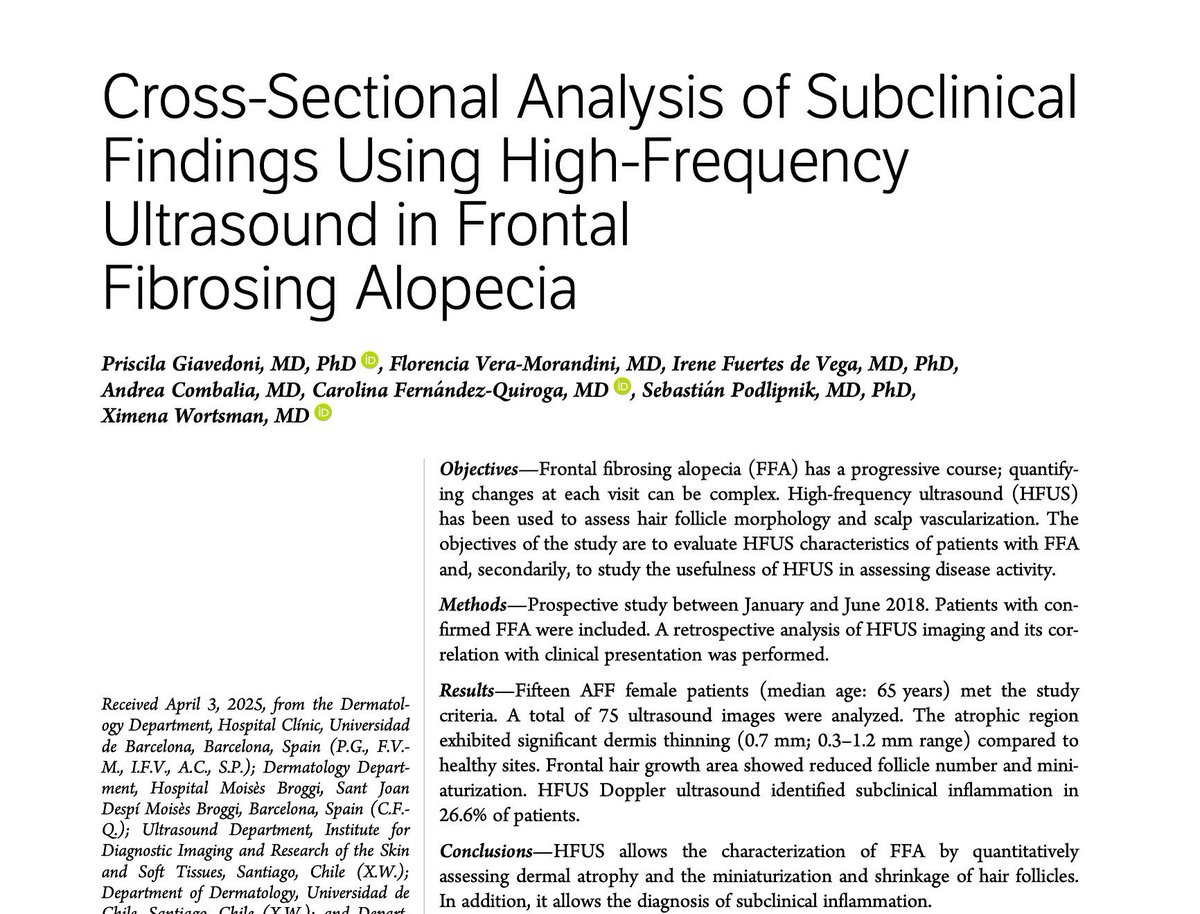 🧠✨ New Study Alert!
High-Frequency Ultrasound (HFUS) in Frontal Fibrosing Alopecia (FFA)
📌 HFUS reveals structural changes in the scalp and helps detect subclinical inflammation in FFA—even when clinical signs are absent!
🖼️ Key findings:
🔹 Dermal thinning and follicular