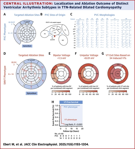 The Relevance of the Type of Ventricular Arrhythmia in Titin-Related Dilated Cardiomyopathy: A Multicenter Study | JACC: Clinical Electrophysiology 

Small cohort of TTNtvs with high arrhythmic burden (PVCs) or SMVT. 
SMVT origin: septal predominance
Complete abolition of PVCs