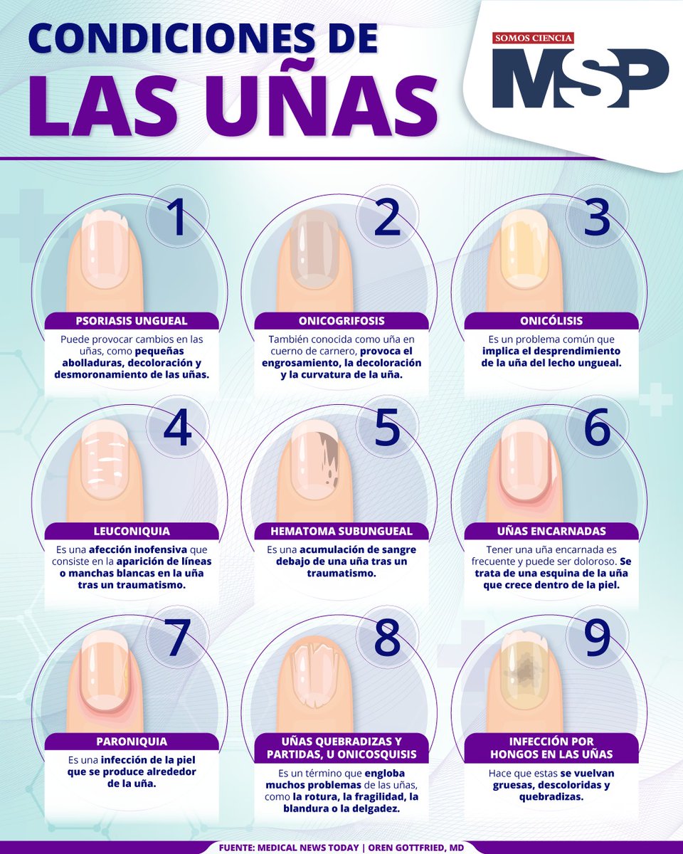 #InfografíaMSP 💅 | Las uñas no solo cumplen una función estética, también pueden reflejar lo que está ocurriendo dentro del cuerpo. Cambios en su color, forma o grosor pueden ser signos tempranos de enfermedades como anemia, problemas hepáticos o infecciones.