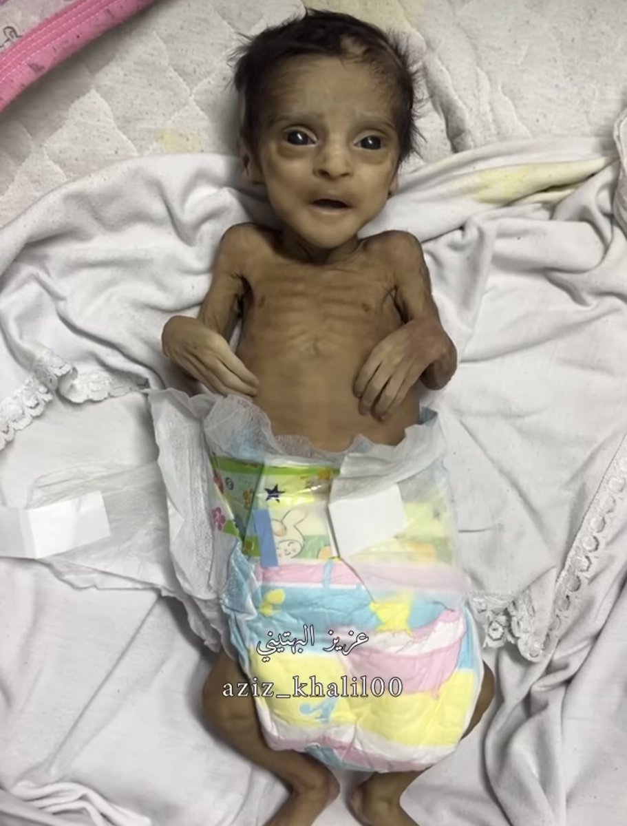 yousef_ki1's tweet image. We are still starving.