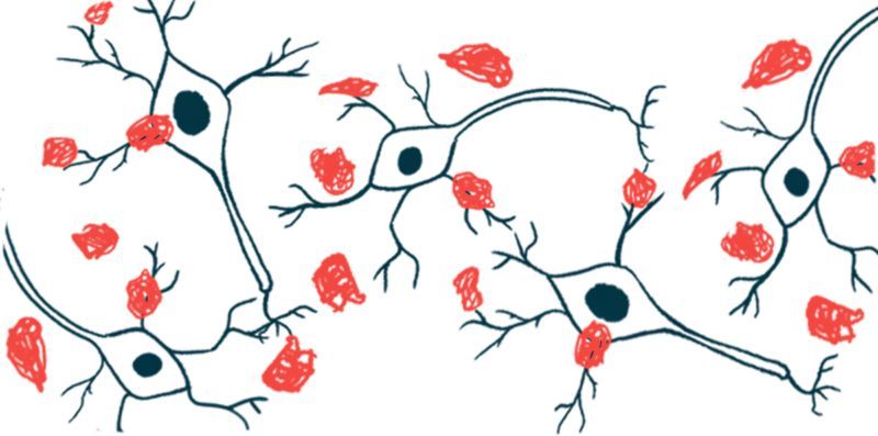 Parkinson's patients have altered levels of certain fat molecules in their brains, which may play a role in disease development, per a study. parkinsonsnewstoday.com/news/levels-fa…