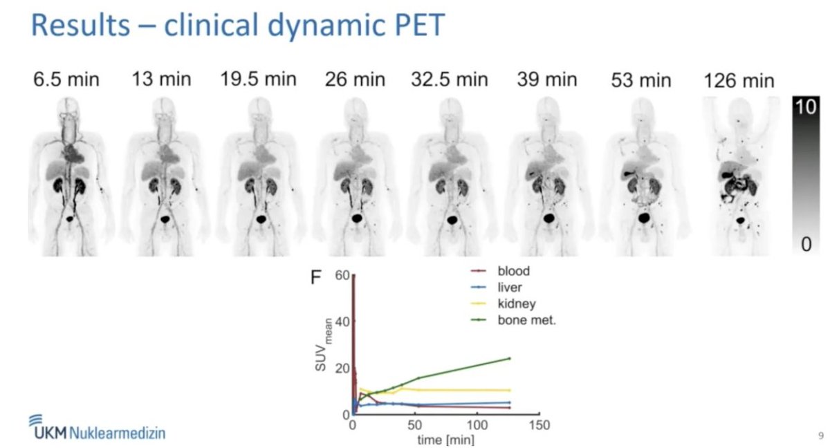 A new theranostic target in #ProstateCancer: First results from ...