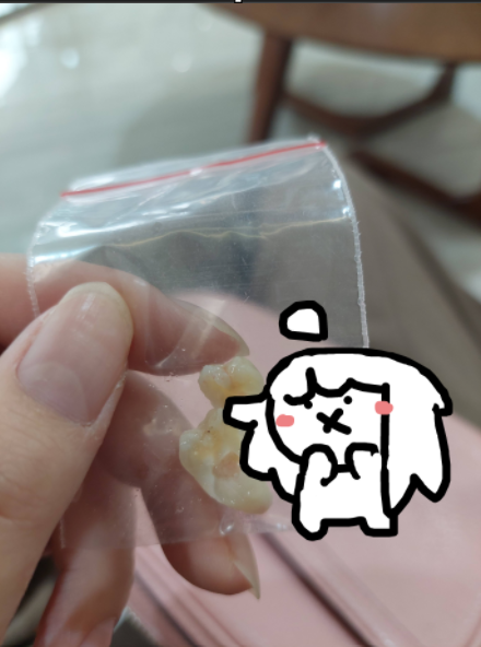 I got my wisdom forcibly removed from me