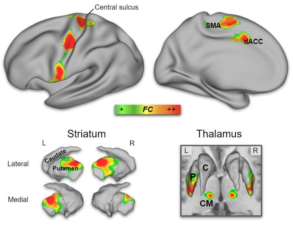 Alert!!!!  Anybody out there?!?!

“An Action Networks Model for Pain”  

We propose a new model for chronic pain  — and highlight two functionally connected cortical networks that could revolutionize how we treat it.  

👉 thread below 🧵  

osf.io/preprints/ps...