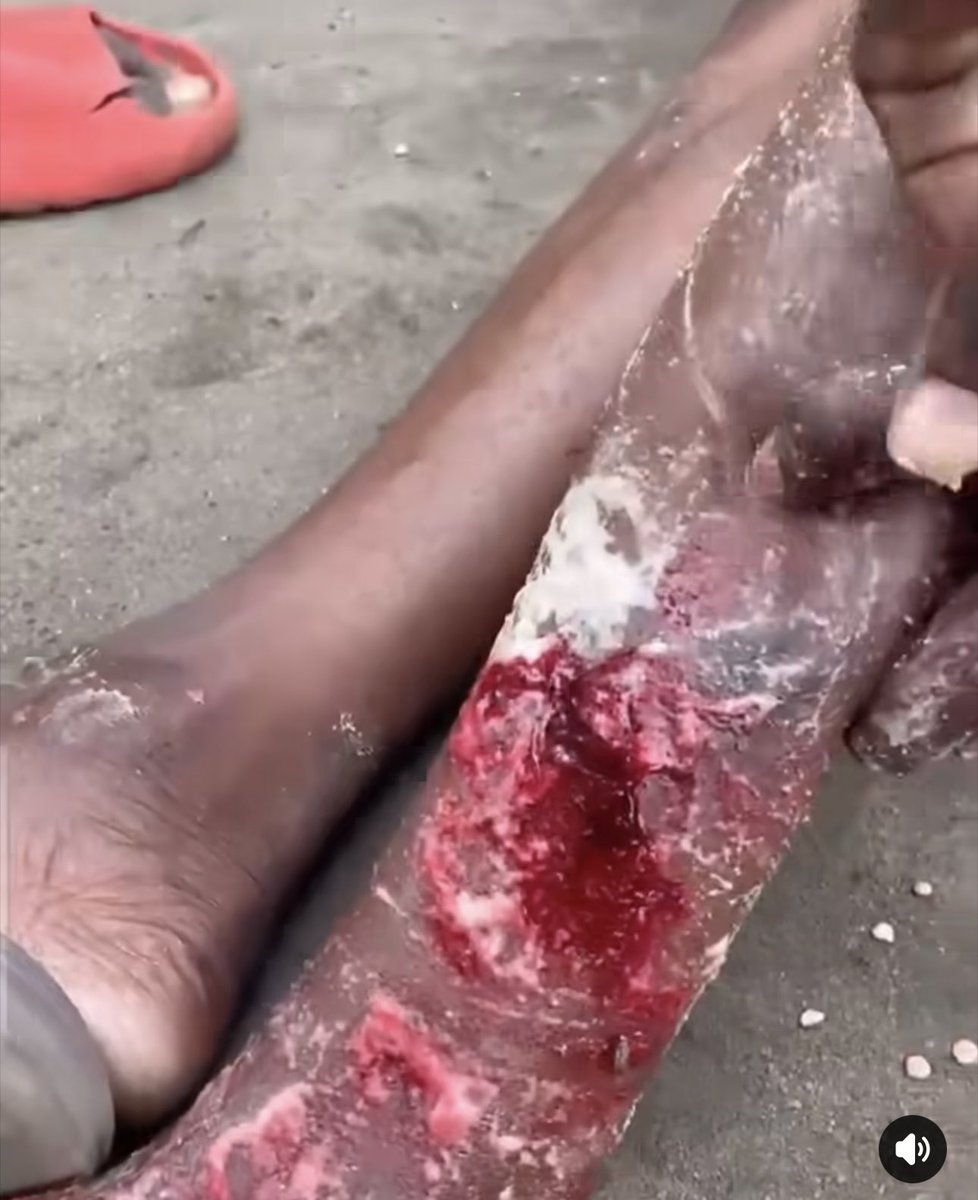 KNLangueh's tweet image. #Togo🇹🇬 
Monsieur le Ministre @CBMadjoulba! Je vous interpelle personnellement parce que vous venez de salir les mains en injectant des #miliciens #armés sur des populations aux mains nues. L'usage de cette méthode de vieille époque ne vous ressemble pas. @FEGnassingbe va partir