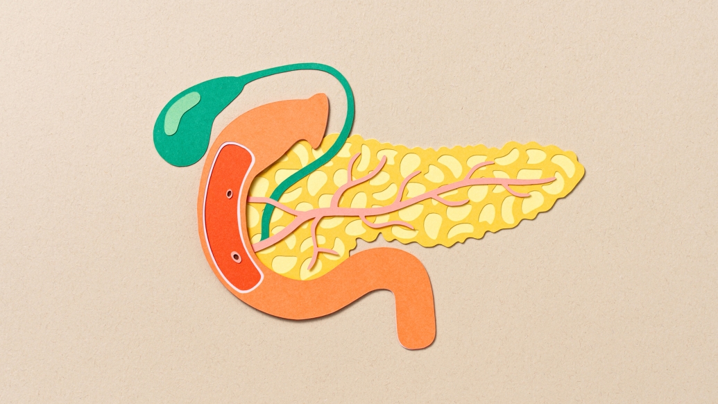 UMichMedScience's tweet image. Acute pancreatitis that can become chronic w/out proper care is a common gastrointestinal condition requiring inpatient hospital care. @timofran1 (@UMICHpancreas) identifies 2 protein signals that prove crucial in healing from acute & chronic pancreatitis. michmed.org/ygNe3