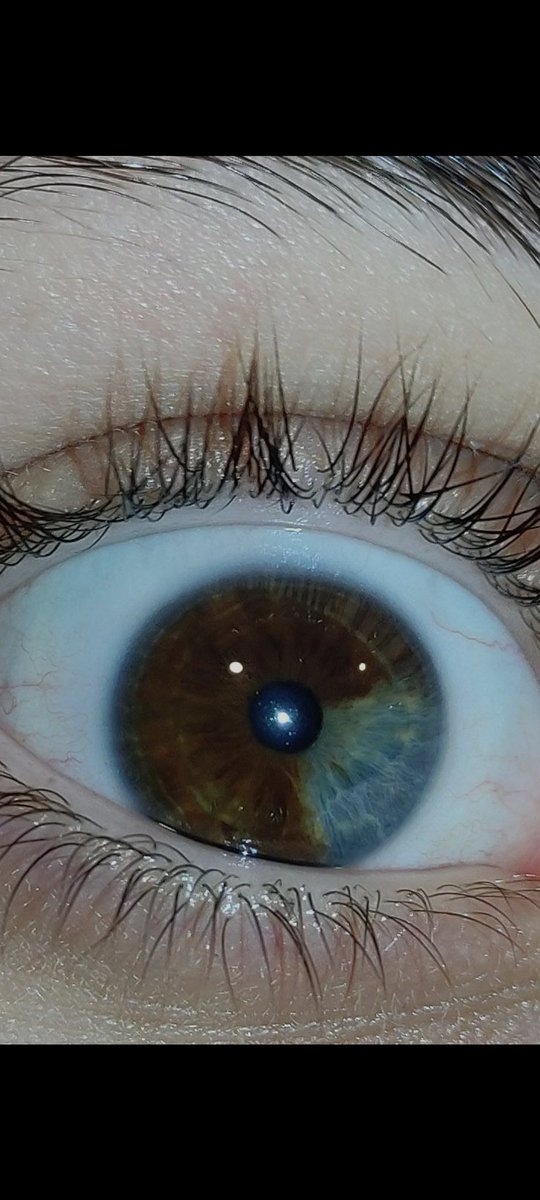 Babacım tek renk göz değil ikisi bir arada en iyisi