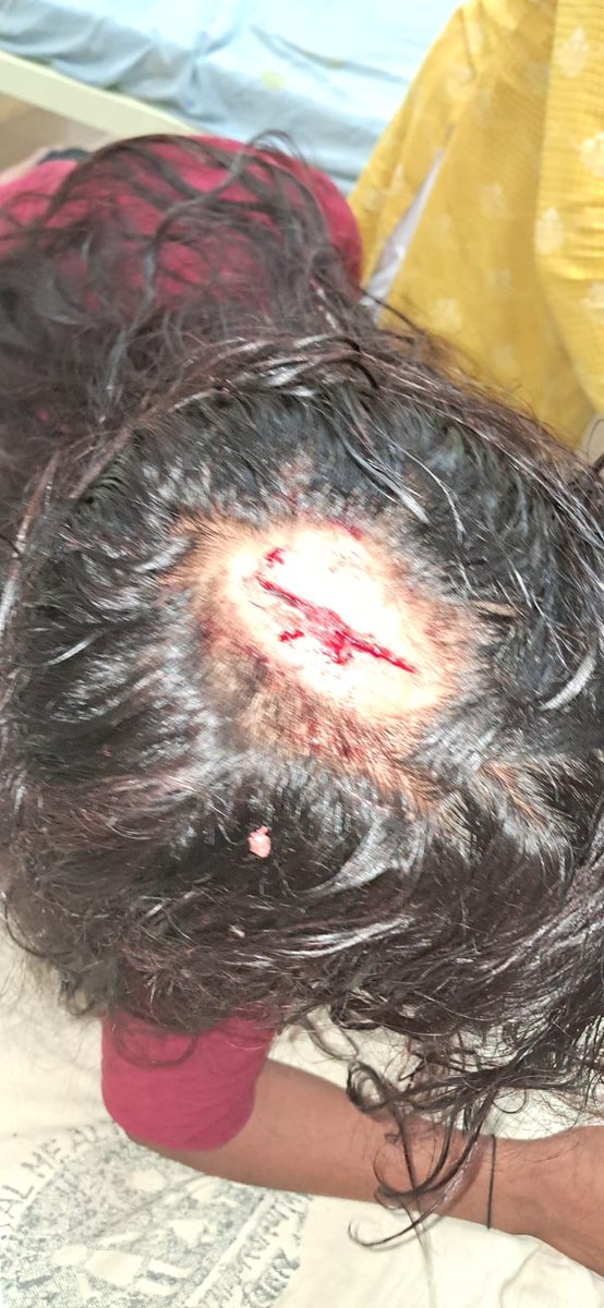 vishnucool87's tweet photo. @NitishKumar Bihar ki Kanoon bahut kharab hai police prashasan help nahin karta hai Ham Garib Hain hamen Insaaf nahin mila abhi tak Meri bahan ko jo aaropi Ne mara hai usko abhi tak police prashasan ki taraf se girftar nahin kiya gaya hai yah jila Madhubani Thana raika gaon sourath ka mamla https://t.co/9OU4L5LkWu