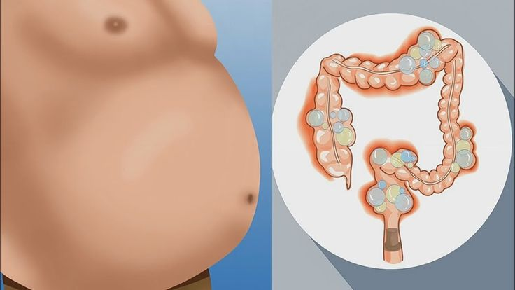 jesus_osorior's tweet photo. No todo lo que parece sano… lo es.

Hay alimentos que se venden como “limpios” o “naturales”, pero que inflaman tu cuerpo, alteran tus hormonas y sabotean tu salud desde dentro.

Aquí los 8 peores culpables que nadie te menciona: 🧵 https://t.co/sdcbBjQrun