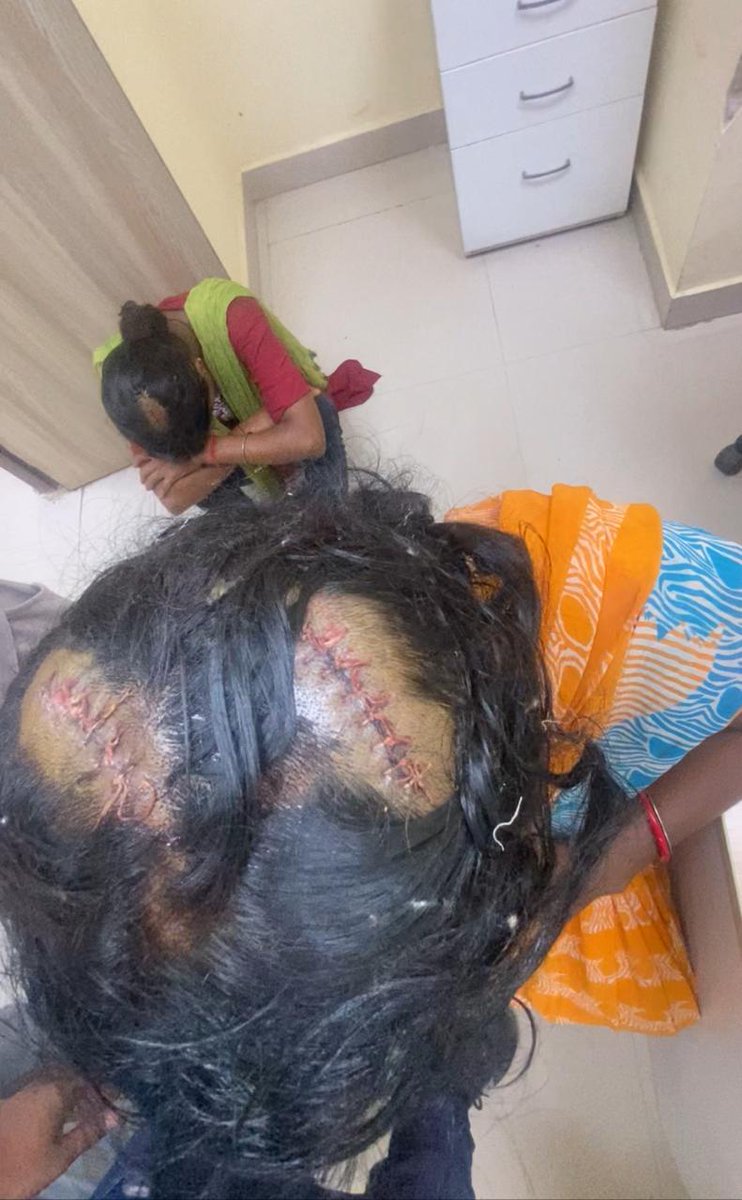 vishnucool87's tweet photo. @ravikishann @myogiadityanath Bihar ki Kanoon bahut kharab hai police prashasan help nahin karta hai Ham Garib Hain hamen Insaaf nahin mila abhi tak Meri bahan ko jo aaropi Ne mara hai usko abhi tak police prashasan ki taraf se girftar nahin kiya gaya hai yah jila Madhubani Thana rahika gaon sourath ka mamla https://t.co/b34JaZ3YoH