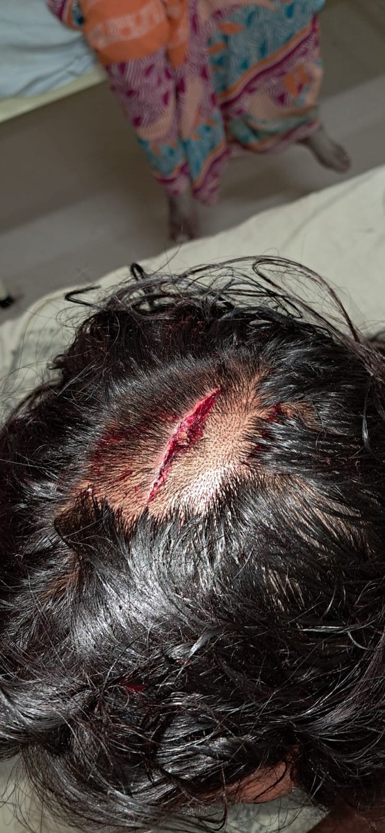vishnucool87's tweet photo. @ravikishann @myogiadityanath Bihar ki Kanoon bahut kharab hai police prashasan help nahin karta hai Ham Garib Hain hamen Insaaf nahin mila abhi tak Meri bahan ko jo aaropi Ne mara hai usko abhi tak police prashasan ki taraf se girftar nahin kiya gaya hai yah jila Madhubani Thana rahika gaon sourath ka mamla https://t.co/b34JaZ3YoH