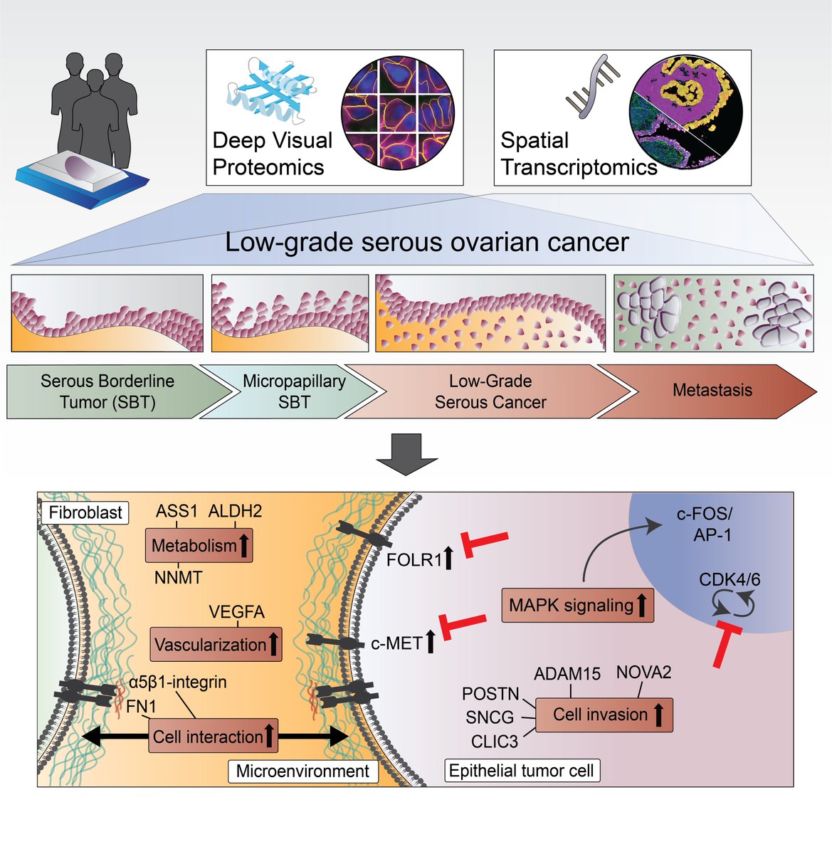 uchicago_obgyn's tweet image. A new publication in @Cancer_Cell uncovers how borderline ovarian tumors evolve into low-grade serous ovarian cancer & identifies a promising new treatment strategy.
Read: bit.ly/4luXCP8
@UCCancerCenter @LisaCSchweizer @hkenny228 @ErnstLengyel @labs_mann @MPI_Biochem