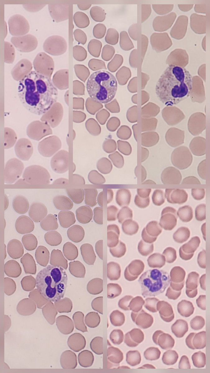 Marc Couturier PhD, D(ABMM) 🕷🦠🔬 tweet media