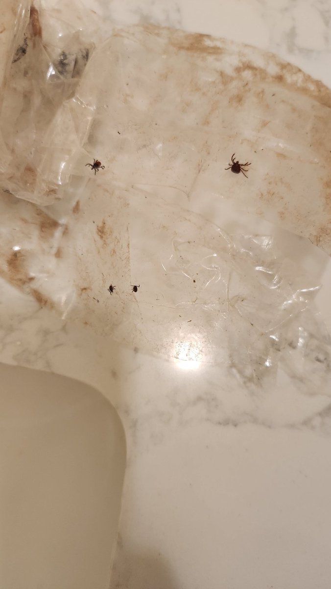 A prime welcome back to the northeast. This poor patient had a rip-roaring case of anaplasmosis diagnosed initially by blood smear and confirmed by PCR.

 The ticks are bad this year!!! (Removed these from my clothes with packing tape after a casual walk in the woods!)