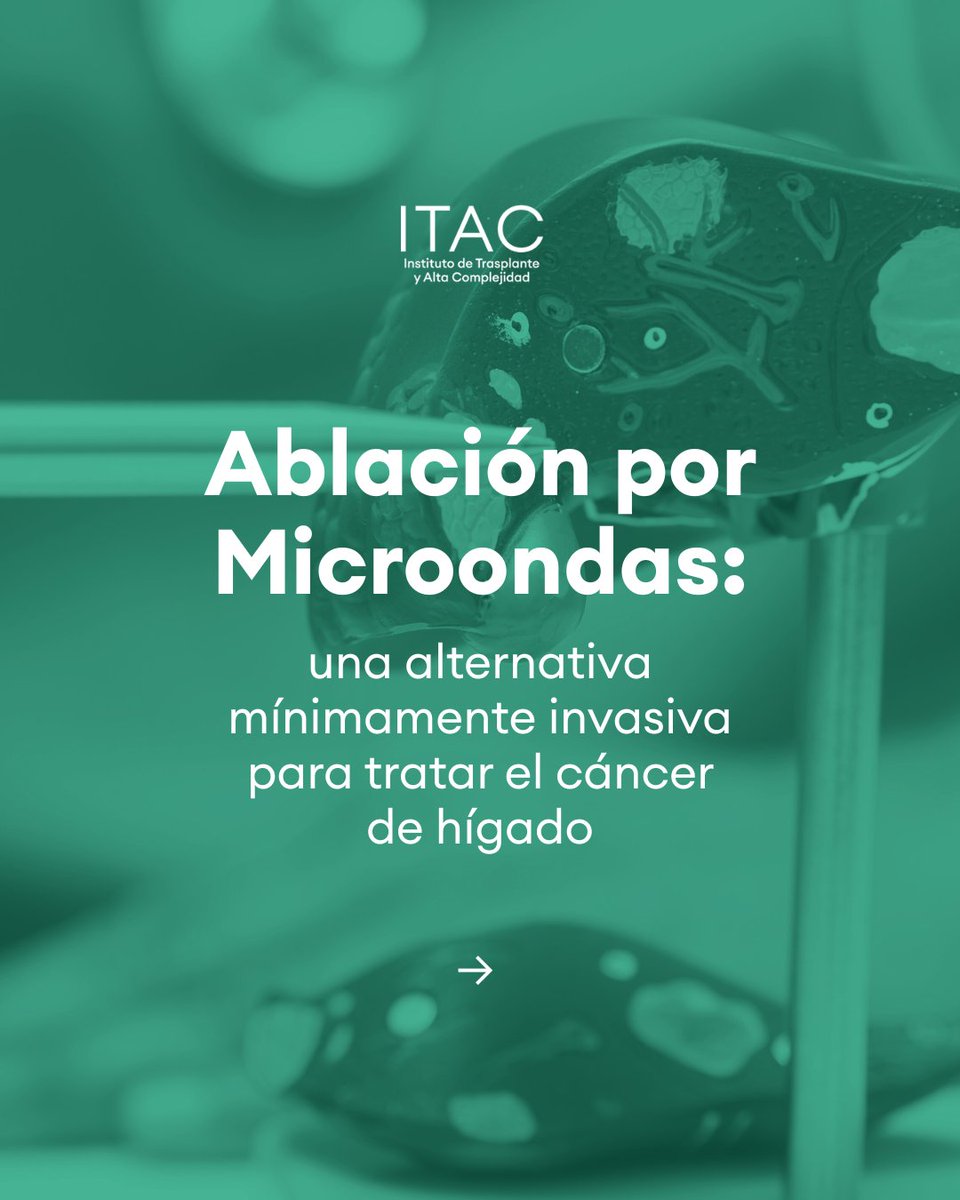 ITACargentina's tweet photo. 👉 La ablación por microondas es una técnica que permite tratar tumores pequeños sin necesidad de cirugía mayor, menos invasiva, con rápida recuperación y alta precisión.

🔍 En este hilo te mostramos cómo funciona y te contamos más sobre esta alternativa innovadora. https://t.co/mVxmQrgprE