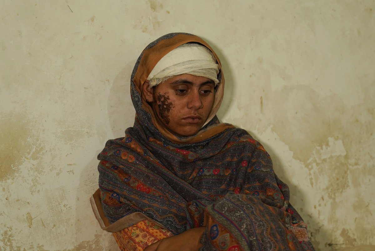 The Progressive (@theprogressive) on Twitter photo Hours after India and Pakistan declared a truce, Kashmiris were plunged again into fear and violence—but for the first time, the hostilities targeted Srinagar.
Read the full story by <a href="/Sajad__Hameed/">Sajad Hameed ( سجاد حمید )</a> and <a href="/Rehanqayoommir/">Rehan Qayoom Mir</a> on The Progressive.
progressive.org/latest/as-bomb… Hours after India and Pakistan declared a truce, Kashmiris were plunged again into fear and violence—but for the first time, the hostilities targeted Srinagar.
Read the full story by <a href="/Sajad__Hameed/">Sajad Hameed ( سجاد حمید )</a> and <a href="/Rehanqayoommir/">Rehan Qayoom Mir</a> on The Progressive.
progressive.org/latest/as-bomb…