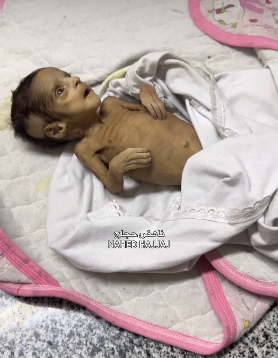 Samira Mohyeddin سمیرا (@smohyeddin) on Twitter photo Ahmed Baha Taleb. Three months old. Died of lack of vitamins and nutrition. Baby formula is one of the items that Israel blocks from being admitted into Gaza.
❌This is what you support unequivocally <a href="/MarkJCarney/">Mark Carney</a> <a href="/AnitaAnandMP/">Anita Anand</a> Ahmed Baha Taleb. Three months old. Died of lack of vitamins and nutrition. Baby formula is one of the items that Israel blocks from being admitted into Gaza.
❌This is what you support unequivocally <a href="/MarkJCarney/">Mark Carney</a> <a href="/AnitaAnandMP/">Anita Anand</a>