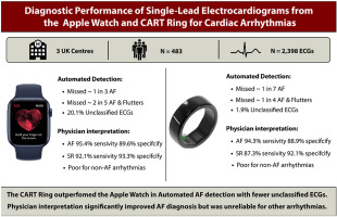 Heart Rhythm O2 (@hrs_o2journal) on Twitter photo Diagnostic performance of single-lead electrocardiograms from a smartwatch and a smartring for cardiac arrhythmia detection
<a href="/OUHospitals/">OUH</a> <a href="/unisouthampton/">University of Southampton</a> <a href="/UHSFT/">University Hospital Southampton š</a> <a href="/PHU_NHS/">Portsmouth Hospitals University NHST</a> <a href="/oxengsci/">Engineering Science, Oxford</a> #EPeeps
heartrhythmopen.com/article/S2666-⦠Diagnostic performance of single-lead electrocardiograms from a smartwatch and a smartring for cardiac arrhythmia detection
<a href="/OUHospitals/">OUH</a> <a href="/unisouthampton/">University of Southampton</a> <a href="/UHSFT/">University Hospital Southampton š</a> <a href="/PHU_NHS/">Portsmouth Hospitals University NHST</a> <a href="/oxengsci/">Engineering Science, Oxford</a> #EPeeps
heartrhythmopen.com/article/S2666-ā¦