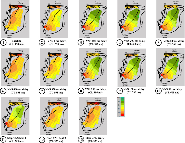 Heart Rhythm O2 (@hrs_o2journal) on Twitter photo Phasic effects of cardiac-synchronized vagus nerve stimulation on spatiotemporal behavior of the sinoatrial node in swine
<a href="/cwru/">Case Western Reserve</a> #EPeeps
heartrhythmopen.com/article/S2666-⦠Phasic effects of cardiac-synchronized vagus nerve stimulation on spatiotemporal behavior of the sinoatrial node in swine
<a href="/cwru/">Case Western Reserve</a> #EPeeps
heartrhythmopen.com/article/S2666-ā¦