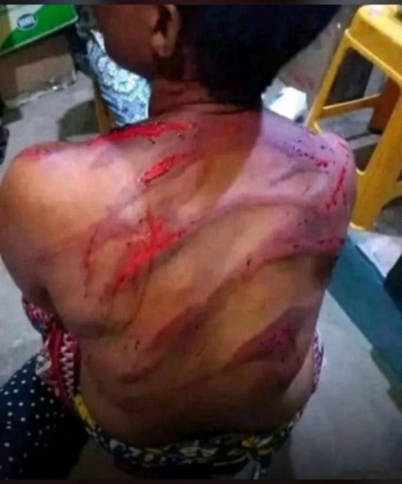 AyidaDany's tweet photo. Une femme sauvagement battue par les forces du régime @FEGnassingbe aujourd’hui à Lomé. Sa seule faute est d’être togolaise et avoir réclamé la liberté et le changement. #FreeTogo #Togo https://t.co/9ghiLLFnYc