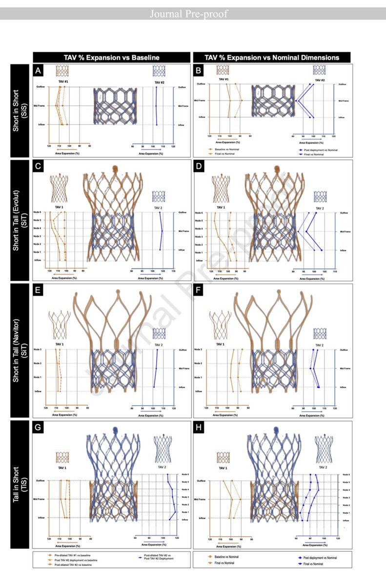 Dr. Gilbert Tang (@gilberttangmd) on Twitter photo JUST OUT #NYV2025 #JACCINT <a href="/JACCJournals/">JACC Journals</a> our FIH report on CT FLUORO analysis of index and 2nd TAV in REDO #TAVR. Index failed TAV 100% underexpanded except functional leaflet area of Evolut. Pre dilate expands 1st short TAV. 2nd TAV 100% underexpanded despite 100% post JUST OUT #NYV2025 #JACCINT <a href="/JACCJournals/">JACC Journals</a> our FIH report on CT FLUORO analysis of index and 2nd TAV in REDO #TAVR. Index failed TAV 100% underexpanded except functional leaflet area of Evolut. Pre dilate expands 1st short TAV. 2nd TAV 100% underexpanded despite 100% post