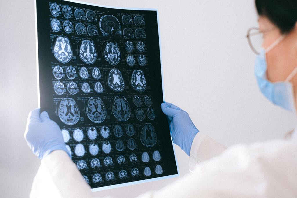 #Aphasia is a language disorder often caused by stroke or brain injury. June is #NationalAphasiaMonth and Healthy Connections Medicaid covers speech therapy for members who qualify, helping them reconnect with the world around them. Learn more by visiting tinyurl.com/3t9pcc66.