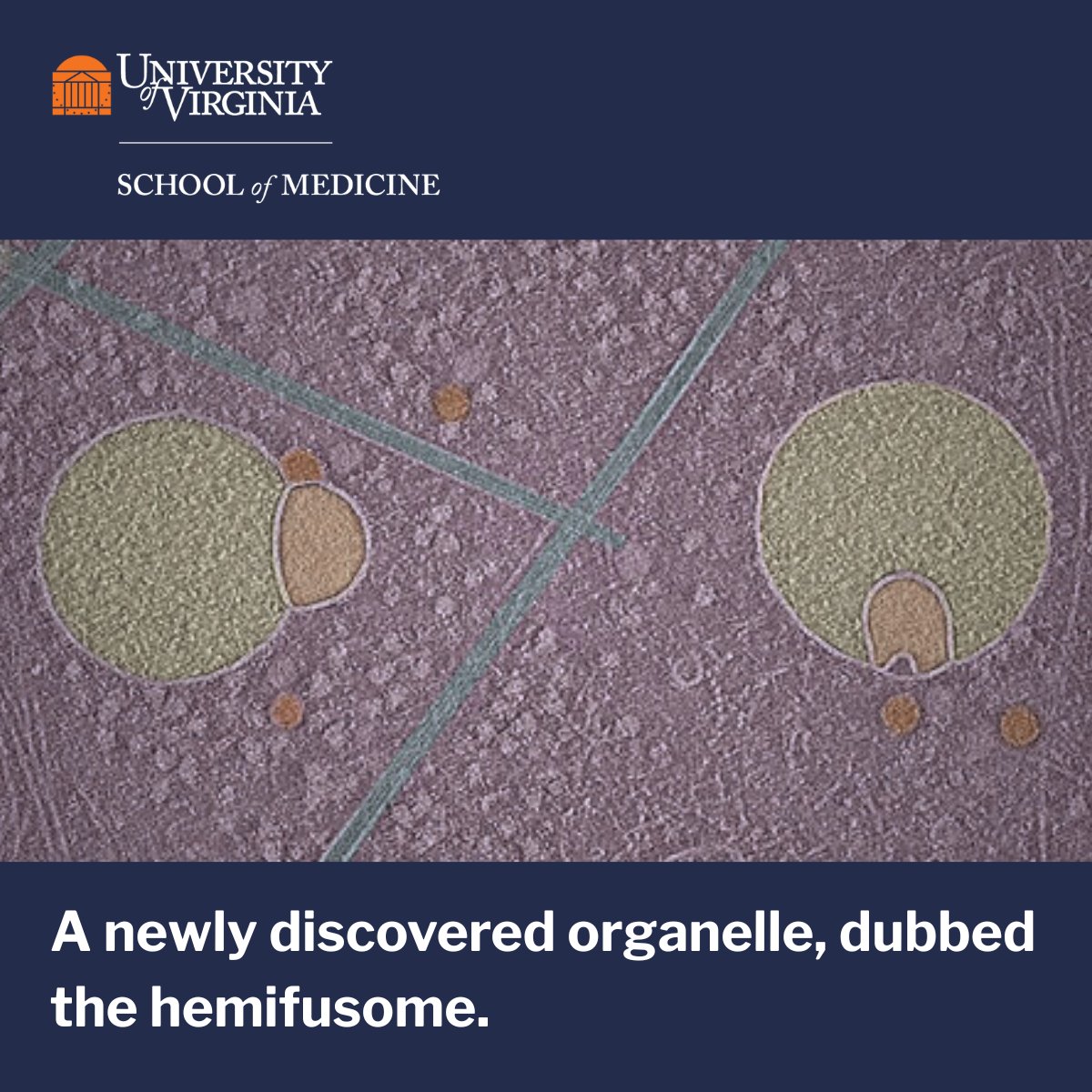 School of Medicine researchers, working with <a href="/NIH/">NIH</a>, have discovered a new cellular structure — and it’s doing some serious housekeeping. Dubbed the hemifusome, this tiny organelle plays a big role in helping cells sort, recycle, and toss out cargo. 

📘 bit.ly/4eqcYCb