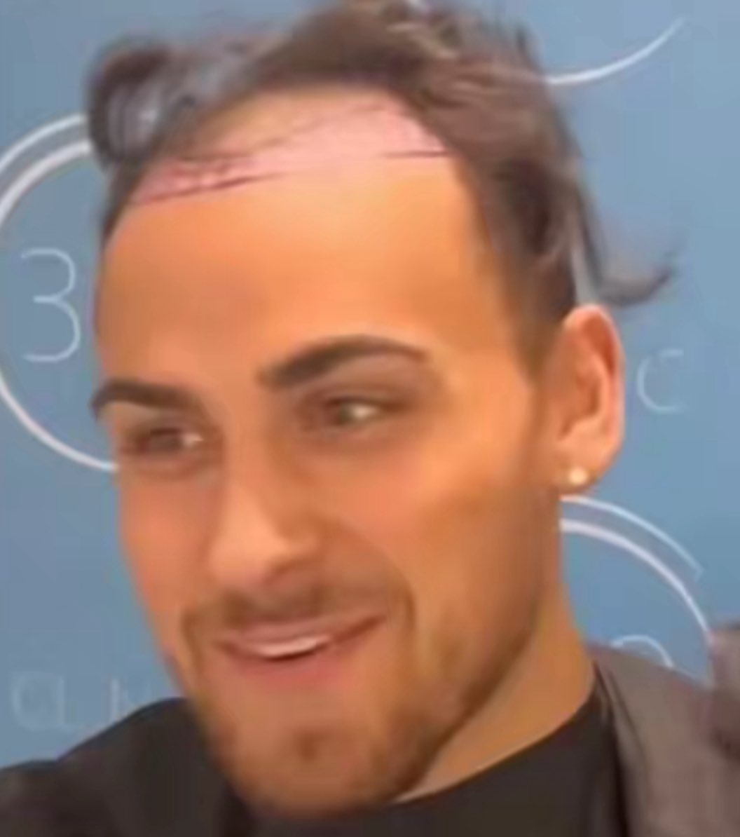 _cp93_'s tweet photo. "No man wants you in this villa"

"Your dead"

Ben, your hair even did a runner from you

#LoveIslandUK https://t.co/9ZN1JuNDEs